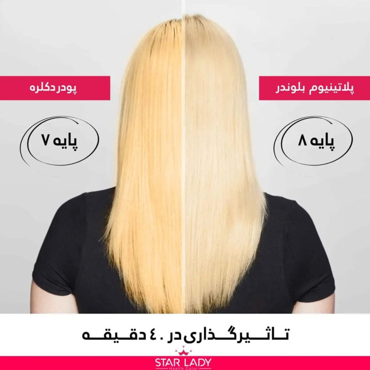 پلاتینه مو استارلیدی