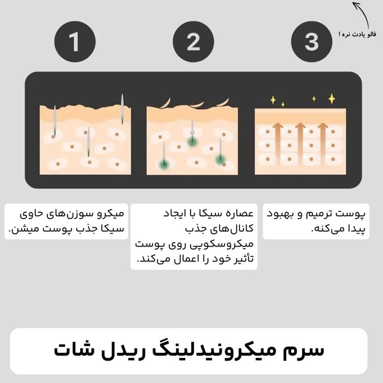 سرم ریدل شات ۱۰۰